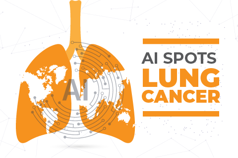 Can AI Predict Lung Cancer in Non Smokers?